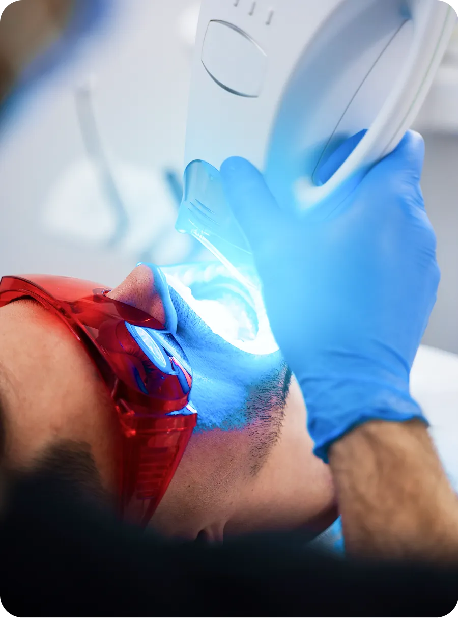 Blanqueamiento dental en Alicante