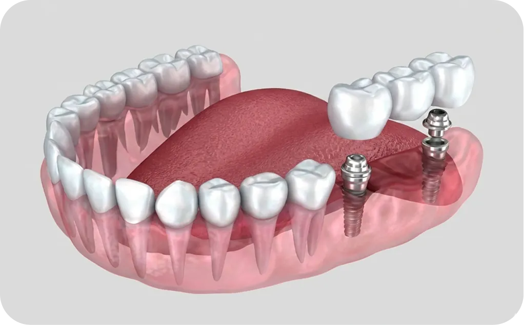 Odontología especializada en Alicante