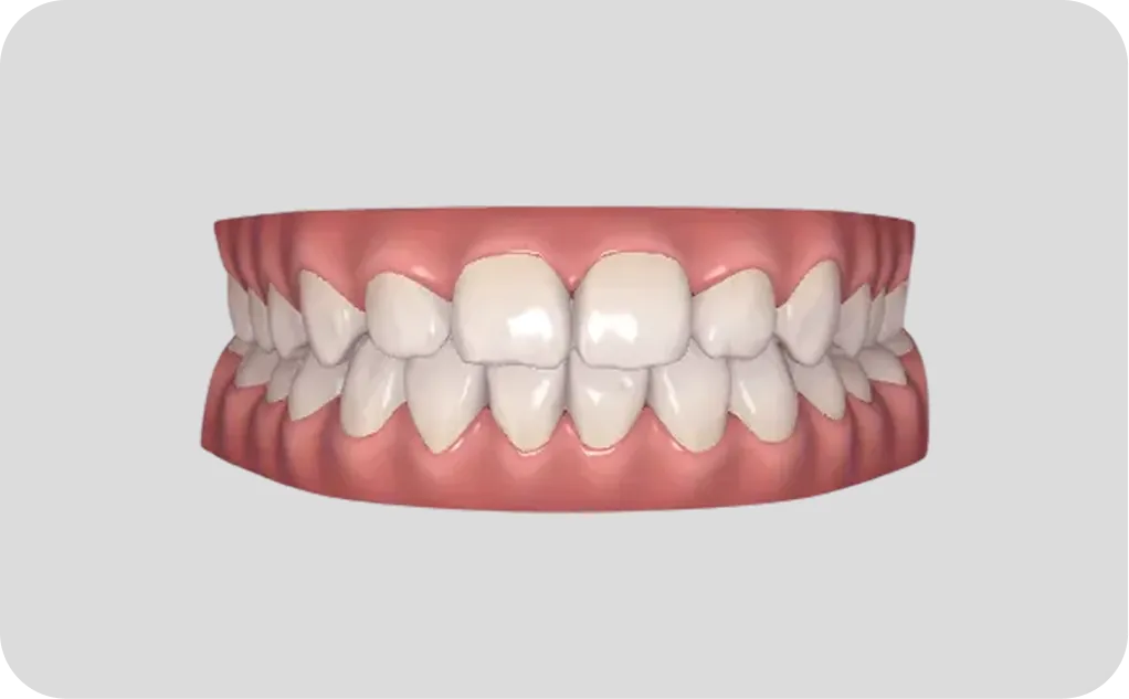 Odontología especializada en Alicante