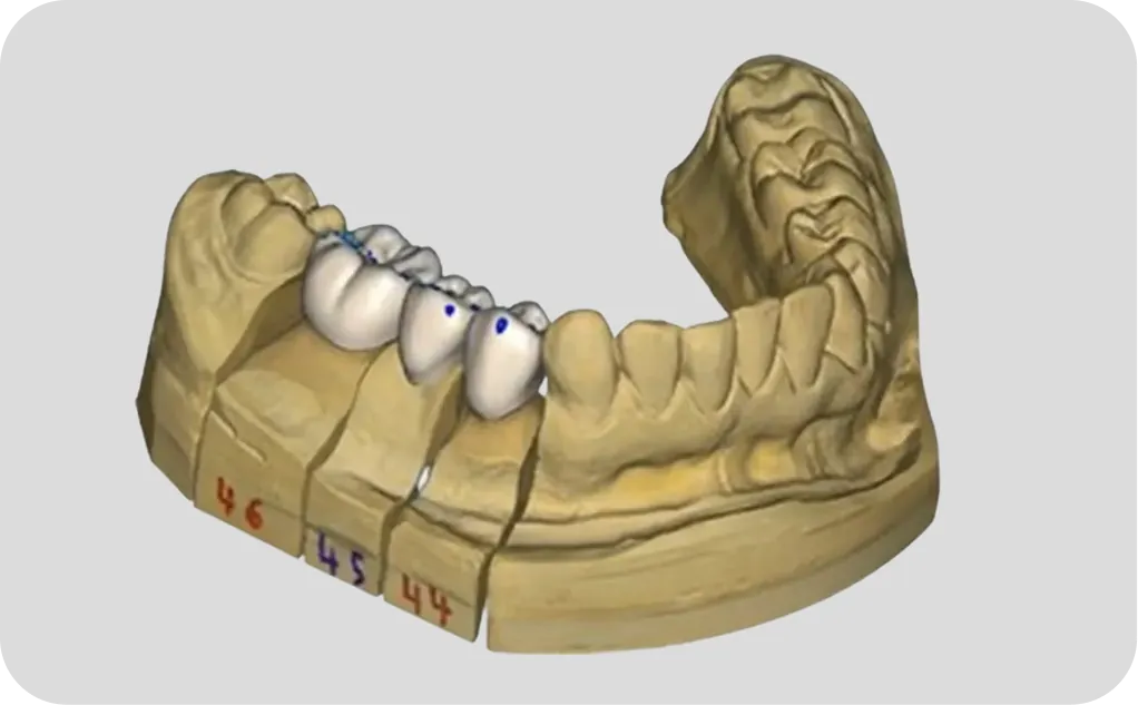 Odontología especializada en Alicante